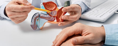 model anatomic cu sistemul reproducator masculin